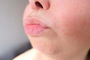 lips, mouth and chin of a middle-aged woman, part of the face close-up, fine wrinkles on the face, spots, cosmetology, plastic surgery and beauty concept, facial massage