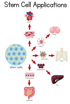 Informative poster of stem cell applications