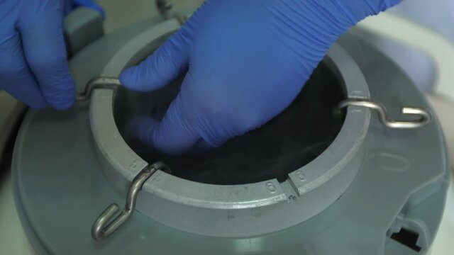 Frozen stem cells in containers removed from a nitrogen barrel