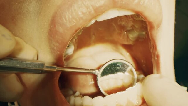 Doctor checks orthodontic retainers after removing braces from the teeth, macro shot