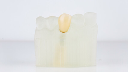 dental model and crown on white background