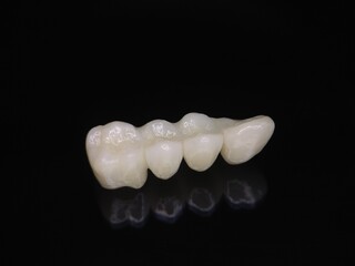 Macro shot of zirconium bridge against dark background with reflection