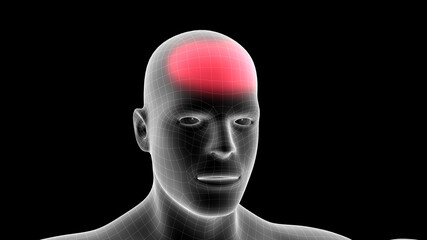 3d illustration of a men xray hologram showing pain area on the head area
