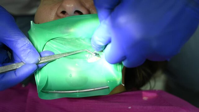 The patient in a chair in the dentist's office, conducts dental procedures, dental treatment.2020