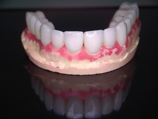 Macro shot of beautiful teeth. Zirconia crowns  on the diagnostic model of the upper jaw against a dark background with reflection
