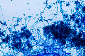 Penicillium, ascomycetous fungi are of major importance in the natural environment as well as food...