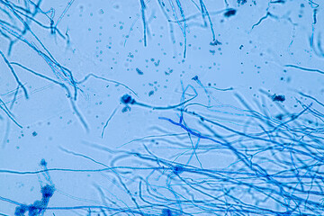 Penicillium, ascomycetous fungi are of major importance in the natural environment as well as food and drug production. 
