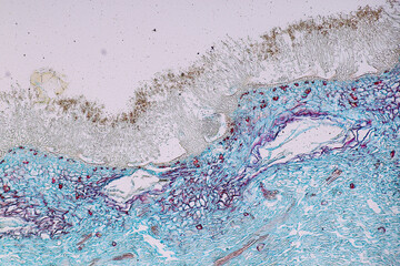 Penicillium, ascomycetous fungi are of major importance in the natural environment as well as food...