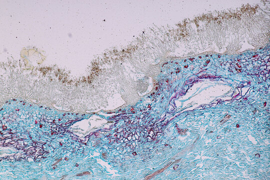 Penicillium, ascomycetous fungi are of major importance in the natural environment as well as food and drug production.&nbsp;
