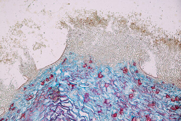 Penicillium, ascomycetous fungi are of major importance in the natural environment as well as food...