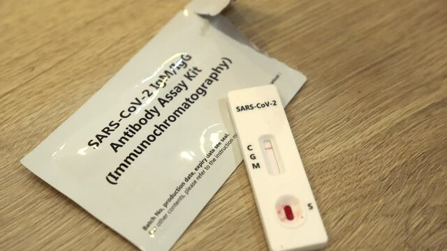 Review of a negative covid 19 blood test. Sars-cov-2 negative on top of the SARS-cov-2 Antibody assay kit package. Negative test results on COVID-19 virus.