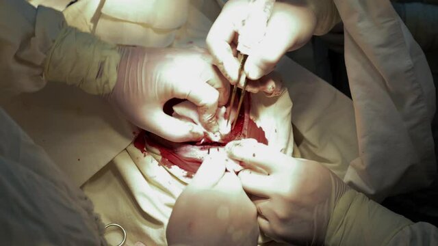 view from above. Neurosurgeons operating on a patient after a head injury