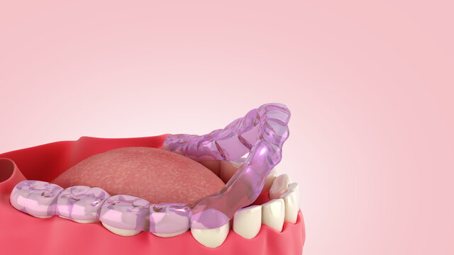 silicone braces on the display stand 3d render on color gradient