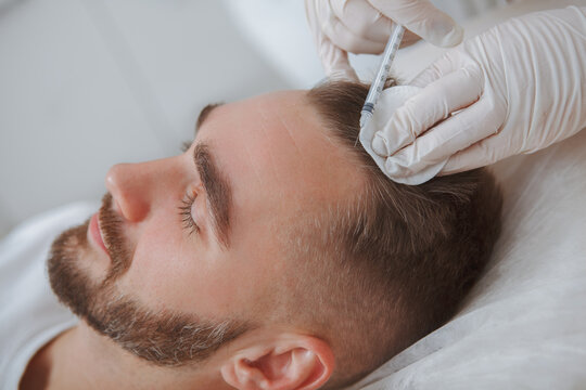 Beautician giving hairloss treatment injections into scalp of male client