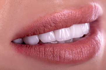 Perfect healthy teeth beautiful wide smile bleaching ceramic crowns whitening of young smiling...