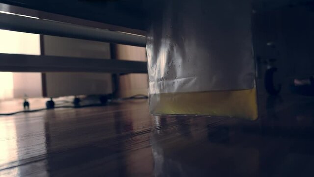 Urine slowly drips into a catheter bag suspended under the hospital bed