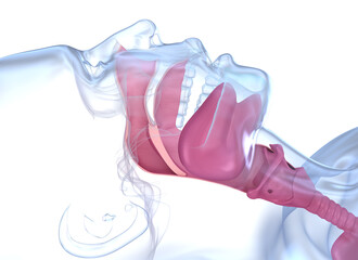Sleep apnea syndrome. Labeled nasal tongue blocked airway, 3D animation - obrazy, fototapety, plakaty