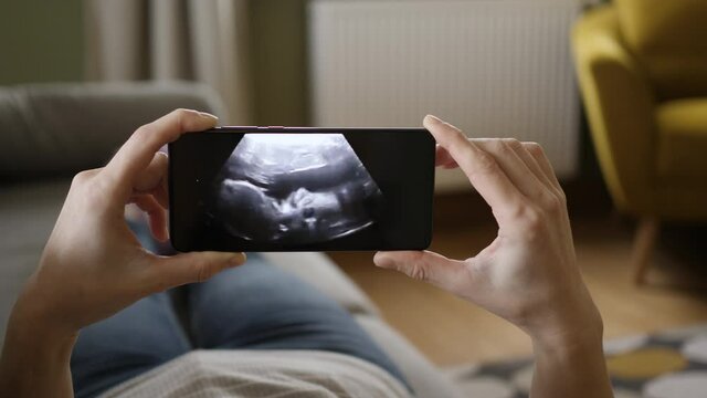 Third trimester pregnancy. Pregnant Woman Looking Ultrasound Video Her Baby on Mobile Phone. Pregnant Woman Looking at Ultrasound Scan on Smartphone Lying on Sofa at Home. Gynecology Birth Childbirth.