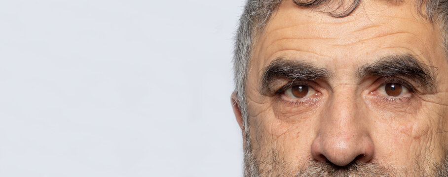 A man with cataracts is a disease of the lens of the human eye, clouding. Comparison of healthy and sick eye banner with place for text on a gray background.