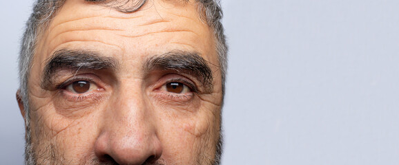A man with cataracts is a disease of the lens of the human eye, clouding. Comparison of healthy and sick eye banner with place for text on a gray background.