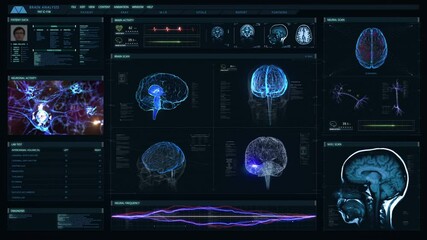 
Futuristic technological interface analyzing human brain anatomy and morphology. Medical profile of patient showing, brain lobes, head MRI scan, neuron cell animation and vital signs. Healthcare info