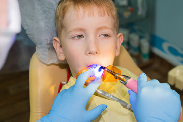 dental office. A 7-year-old child is fitted with a dental seal on the lower jaw bast. Irradiate...