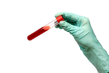 hand in latex glove holding blood sample in test tube close up isolated on white background