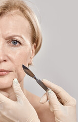 Cropped shot of face of middle aged woman and the medical scalpel in doctors hands isolated over grey background