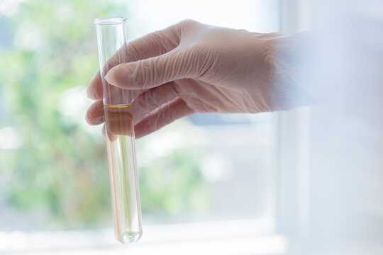 Hand holding test tube with yellow liquid