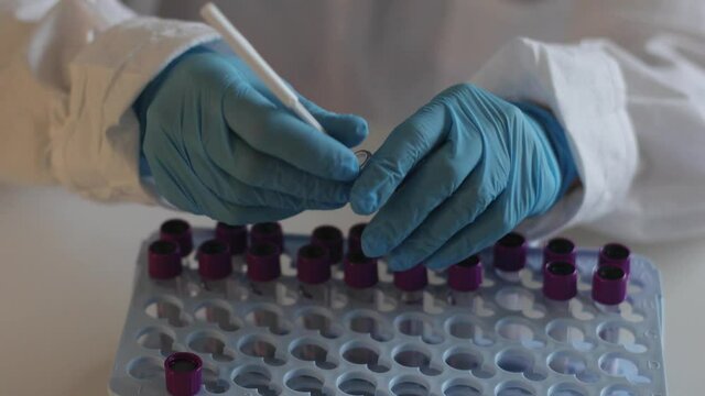 Process of coronavirus testing examination by nurse medic in laboratory lab, COVID-19 swab collection kit, test tube for taking OP NP patient specimen sample, patient receiving a corona test

