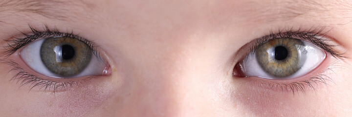 Close-up baby eyes and eyebrows look straight. Treatment and correction of vision in children.