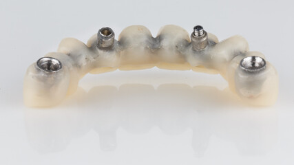 temporary upper jaw prosthesis on a white background, reverse side view