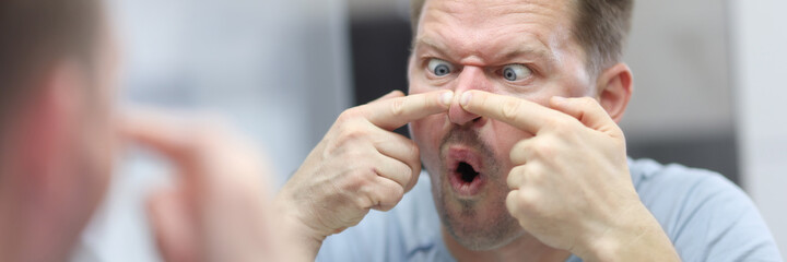 Young man looks in mirror and presses pimples on his nose. Facial skin care procedures at home concept.