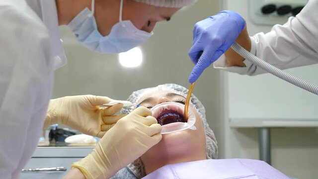 Dental professional orthodontist cleaning. Oral hygiene and prophylactic cleaning. Young woman getting teeth cleaning procedure in modern dentistry. Patient with retractor. 4 k video