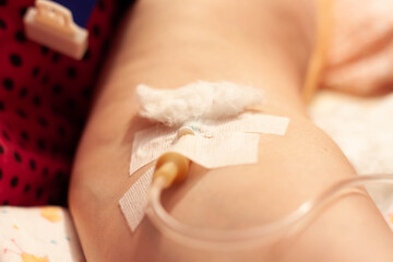 Patient's hand with a medical dropper. Treating people for coronavirus.