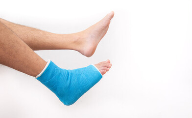 Bone fracture foot and leg on male patient close up.