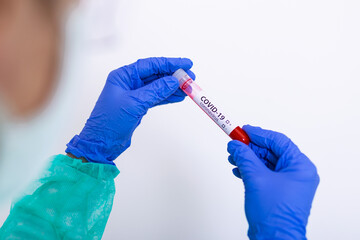 testing blood samples for the virus: the epidemiologist takes blood tests for coronavirus. epidemic...
