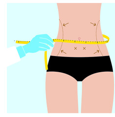 Woman waist plastic surgery in clinic. Vector illustration