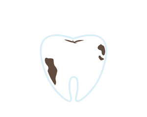 Vector illustration set of teeth. Caries. Dental clinic