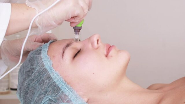 Fractional mesotherapy.A young beautiful woman in the cosmetologist&rsquo;s office receives fractional mesotherapy for her face. Facial skin rejuvenation. Acne treatment. Hardware cosmetology. Beautician.