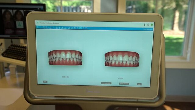 Lady dentist comparing dental images with her patient on the computer