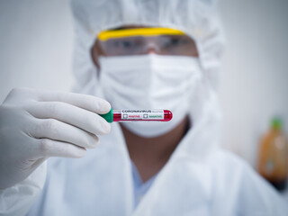 The lab staff is examining the blood results of a patient suspected of being infected with the coronavirus.