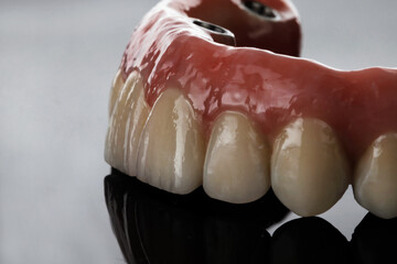 aesthetics of the dental prosthesis of the upper jaw on the mirror with beautiful highlights