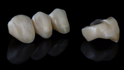 beautiful dental crowns ceramic inlays on a black background