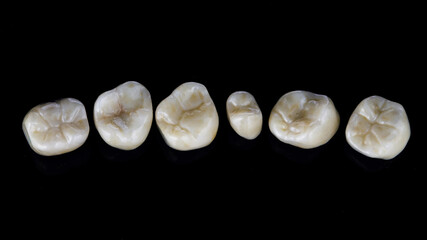 set of ceramic dental inlays, macro photo on a black background