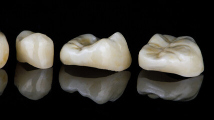 dental inlays made of ceramic close-up on black glass