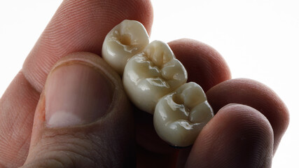 ceramic dental bridge with aesthetics, filmed in hand on white background
