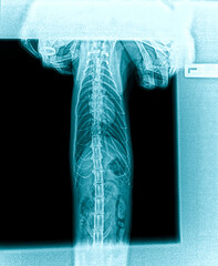 X-ray of a cat's internal organs - chest, stomach, kidneys. Back side shot. Veterinary clinic services. The picture shows the fingers with the doctor's wedding ring.
