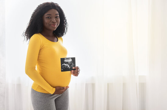 Happy pregnant black woman showing her baby sonography