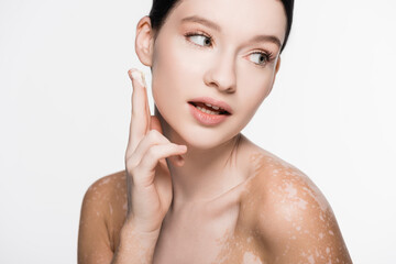 young beautiful woman with vitiligo applying cosmetic cream isolated on white